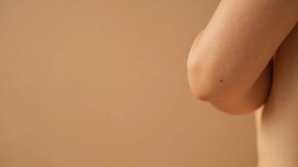 Pourquoi l'épilation laser des aisselles pourrait-elle surprendre ?
